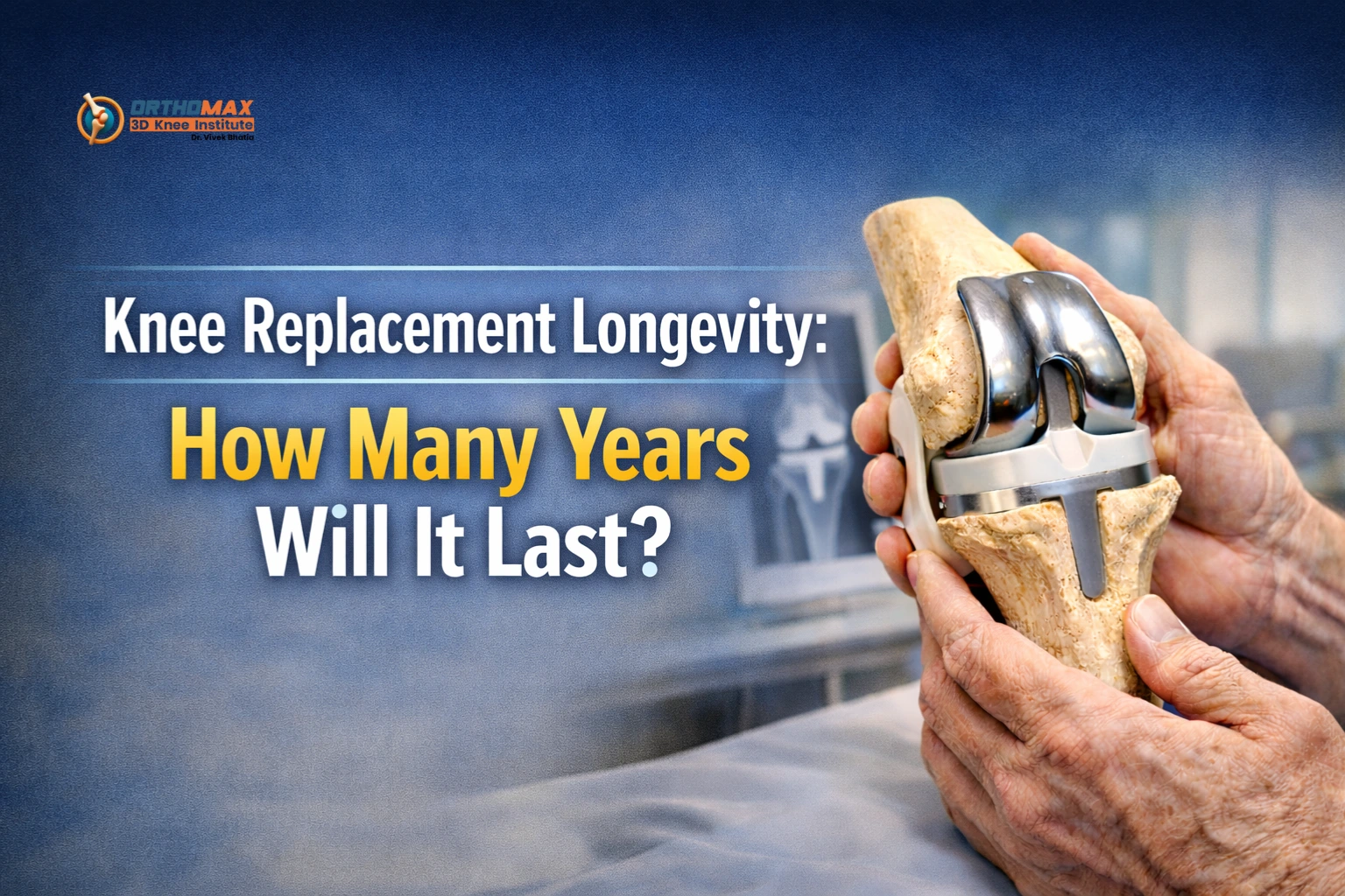 Knee Replacement Longevity: How Many Years Will It Last?