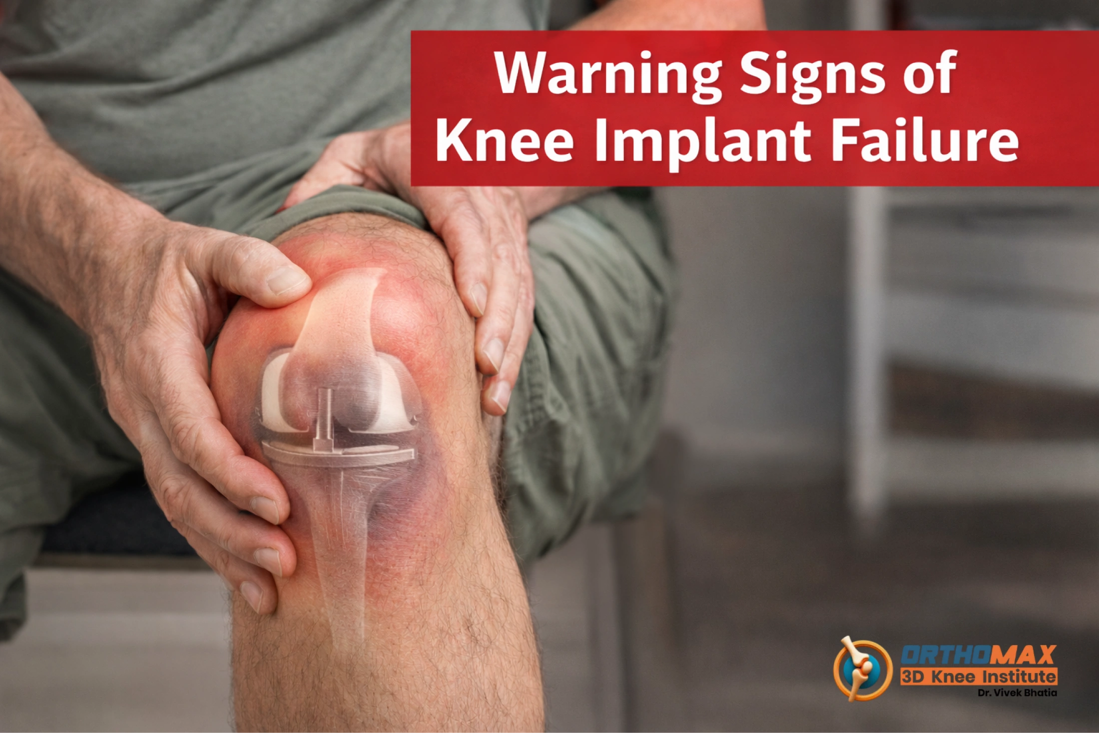 Why Recognizing Knee Implant Failure Symptoms Matters