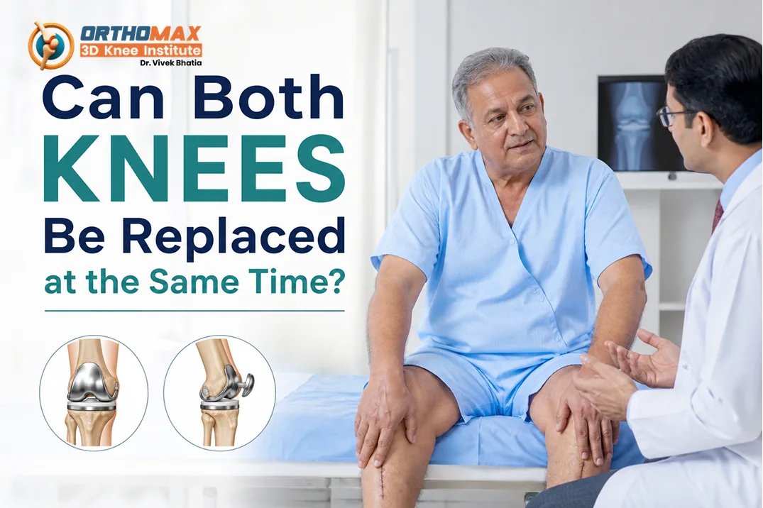 Can Both Knees Be Replaced at the Same Time?